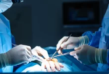 Эндопротезирование мелких суставов кистей: показания, подготовка и ход операции